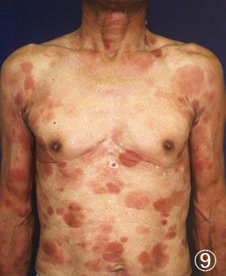 �畆�^ATL���ÑO