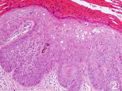 �{�[�G���a