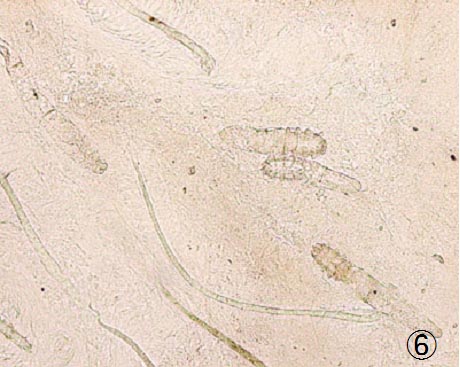 �j�L�r�_�j