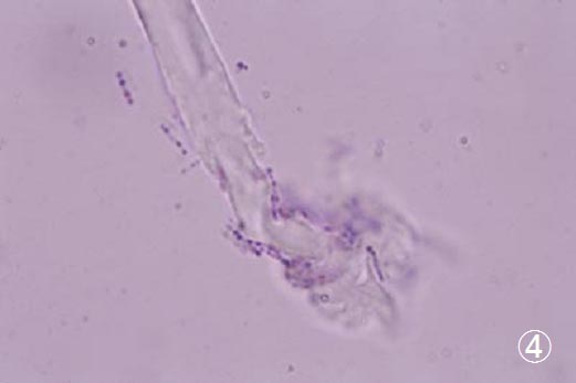 �t�\�o�N�e���A