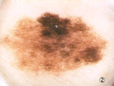 �������F��