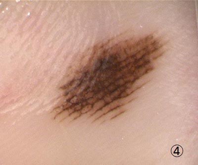 ����F�f�����