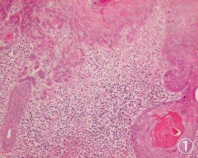 �L���זE��