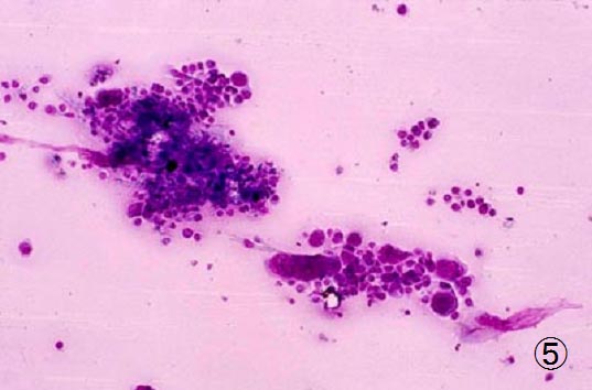 �E�B���X�����זE