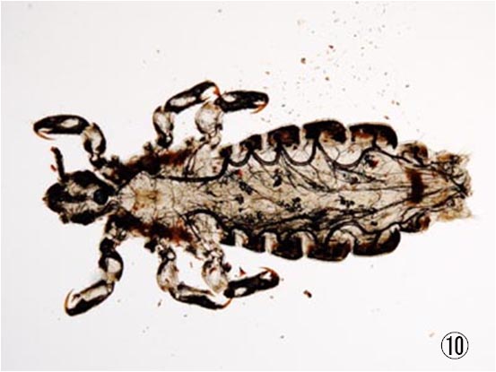 �A�^�}�W���~