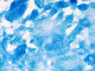 �n���Z���a