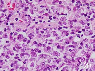 ���������p��2