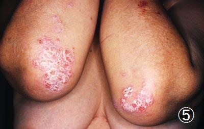 �q�퐫��ᝎ��ÑO