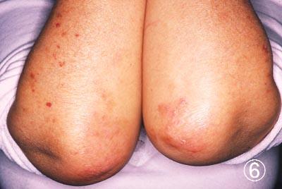 �q�퐫��ᝎ��Ì�