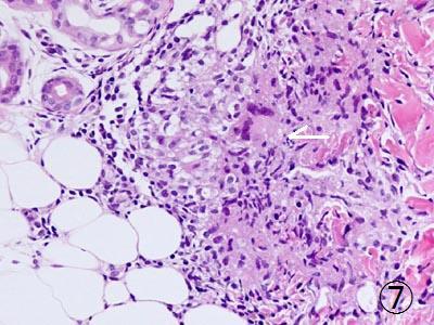 �B�a�����