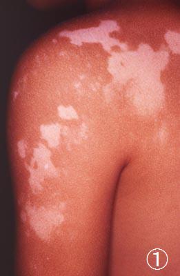 �q�퐫�������ÑO