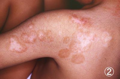 ����2������